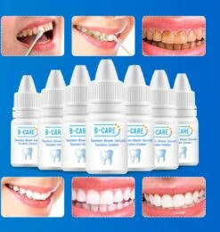 B-care Tanden Bleker – Wittere Tanden – Teeth Whitening Strips – Professioneel Resultaat - Tandsteen Verwijderaar - Zonder Peroxide - Tandenbleekset - Tanden Bleken -BaByliss Verkoopwinkel 1138x1200 9