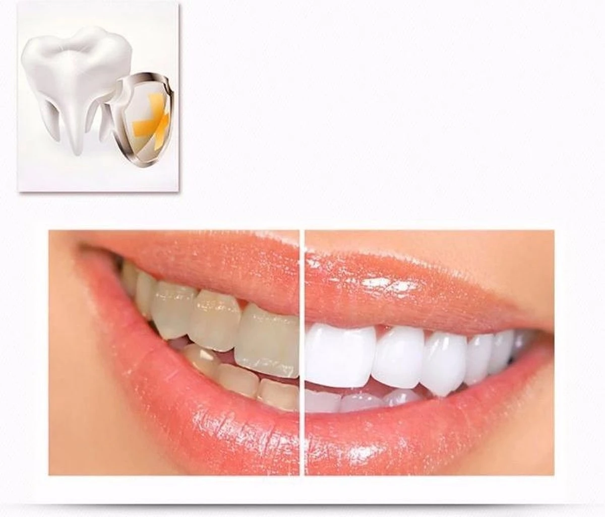 Merkloos Tanden Whitener Pen - Professionele Tandenbleek Gel - Tandenbleker - Afbeelding 3