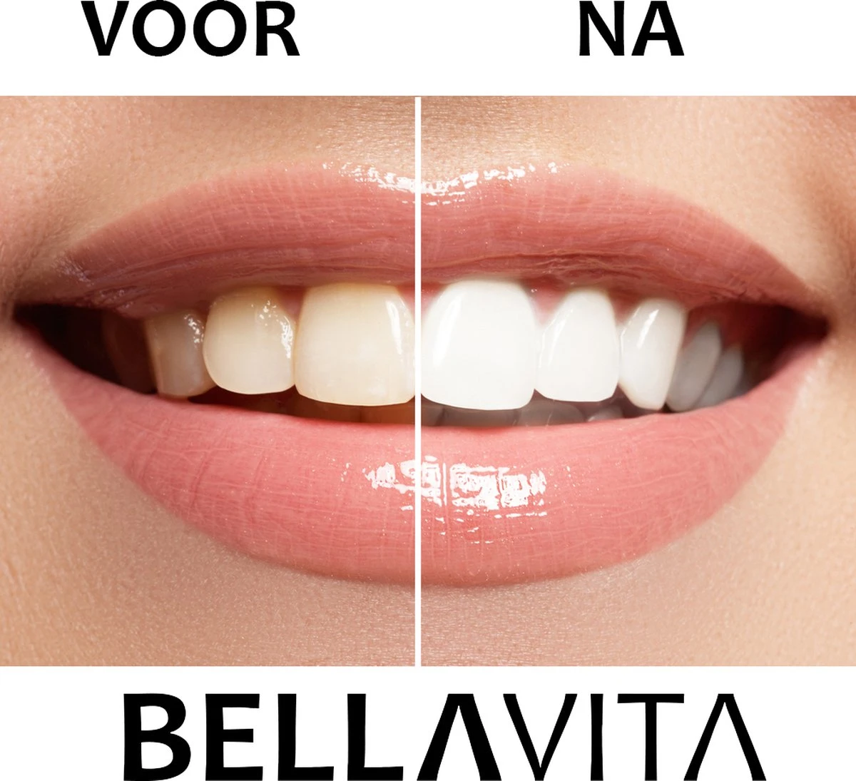 BELLAVITA Tandenbleekset - Tanden Bleken - Teeth Whitening Kit - Tandenblekers - 4 Gelpennen - Zonder Peroxide - 100% Natuurlijk - Witte Tanden - Afbeelding 7