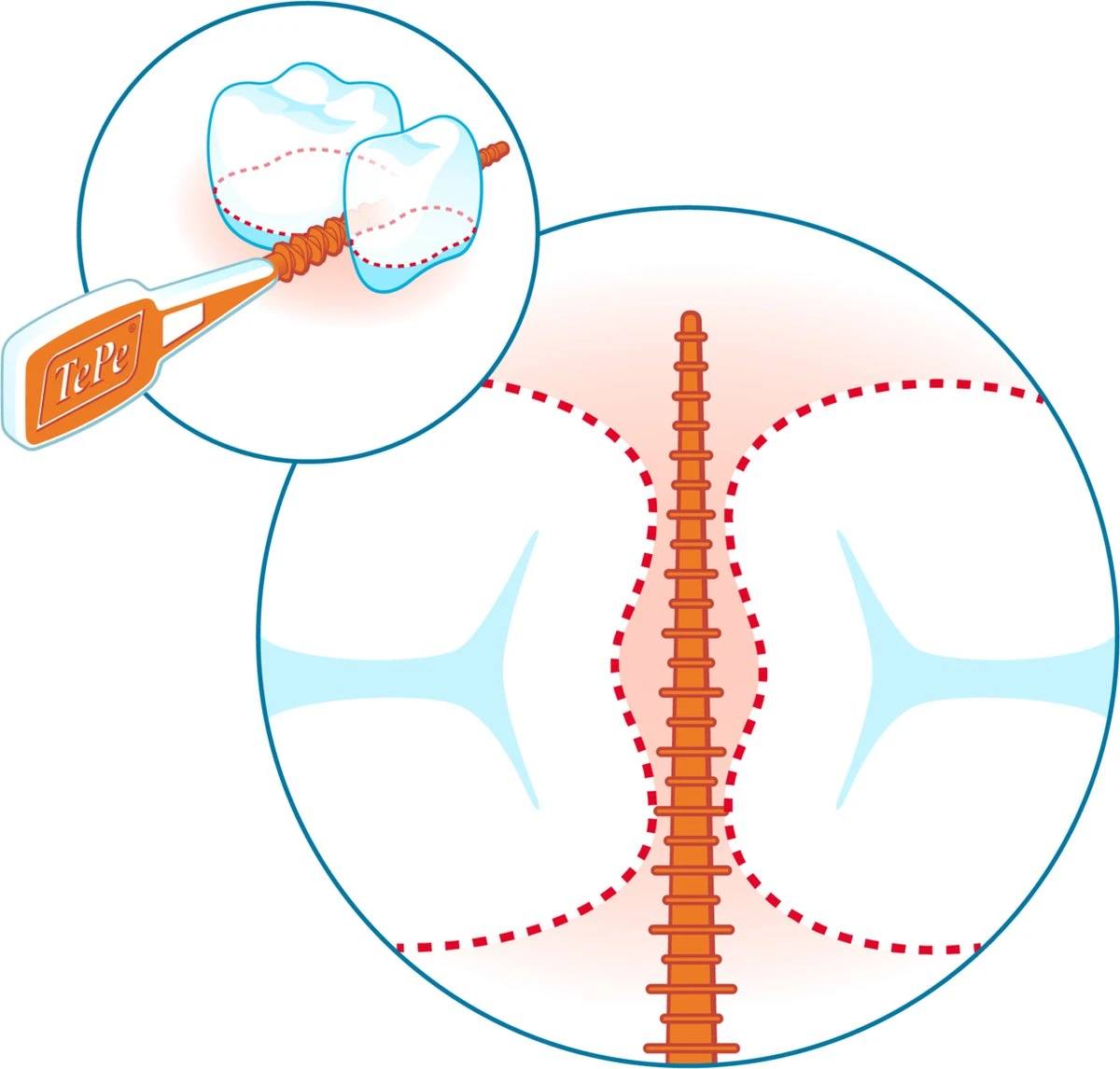 Tepe EasyPick Paars Maat XL – 36 Stuks - Afbeelding 8