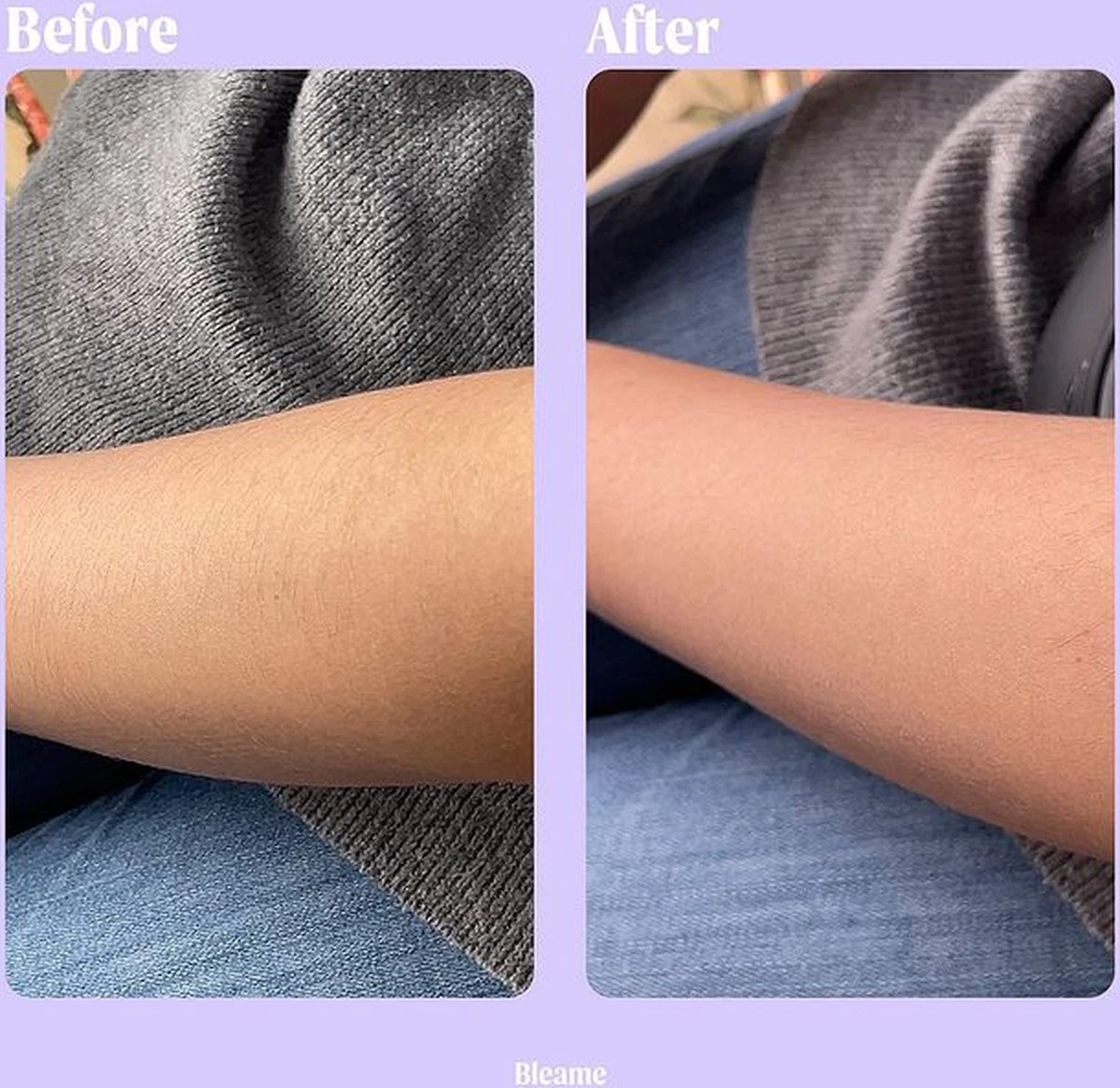 Livingful Premium Crystal Hair Removal • Pijnloos Ontharing Epileerapparaat Voor Armen Benen Rug• Mannen En Vrouwen • Epilator Voor Langdurige Ontharing • Snelle En Gemakkelijke Exfoliërende Ontharin • Haarverwijderaar • Kristalpad • Zijdezachte Huid 10 Livingful Premium Crystal Hair Removal • Pijnloos Ontharing Epileerapparaat Voor Armen Benen Rug• Mannen En Vrouwen • Epilator Voor Langdurige Ontharing • Snelle En Gemakkelijke Exfoliërende Ontharin • Haarverwijderaar • Kristalpad • Zijdezachte Huid - Afbeelding 8