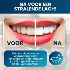 Tandenbleekset - Teeth Whitening - Teeth Whitener - Wittere Tanden - Tanden Bleken - Direct Resultaat - Zelfde Effect Als Whitening Strips -BaByliss Verkoopwinkel 1200x1200 165