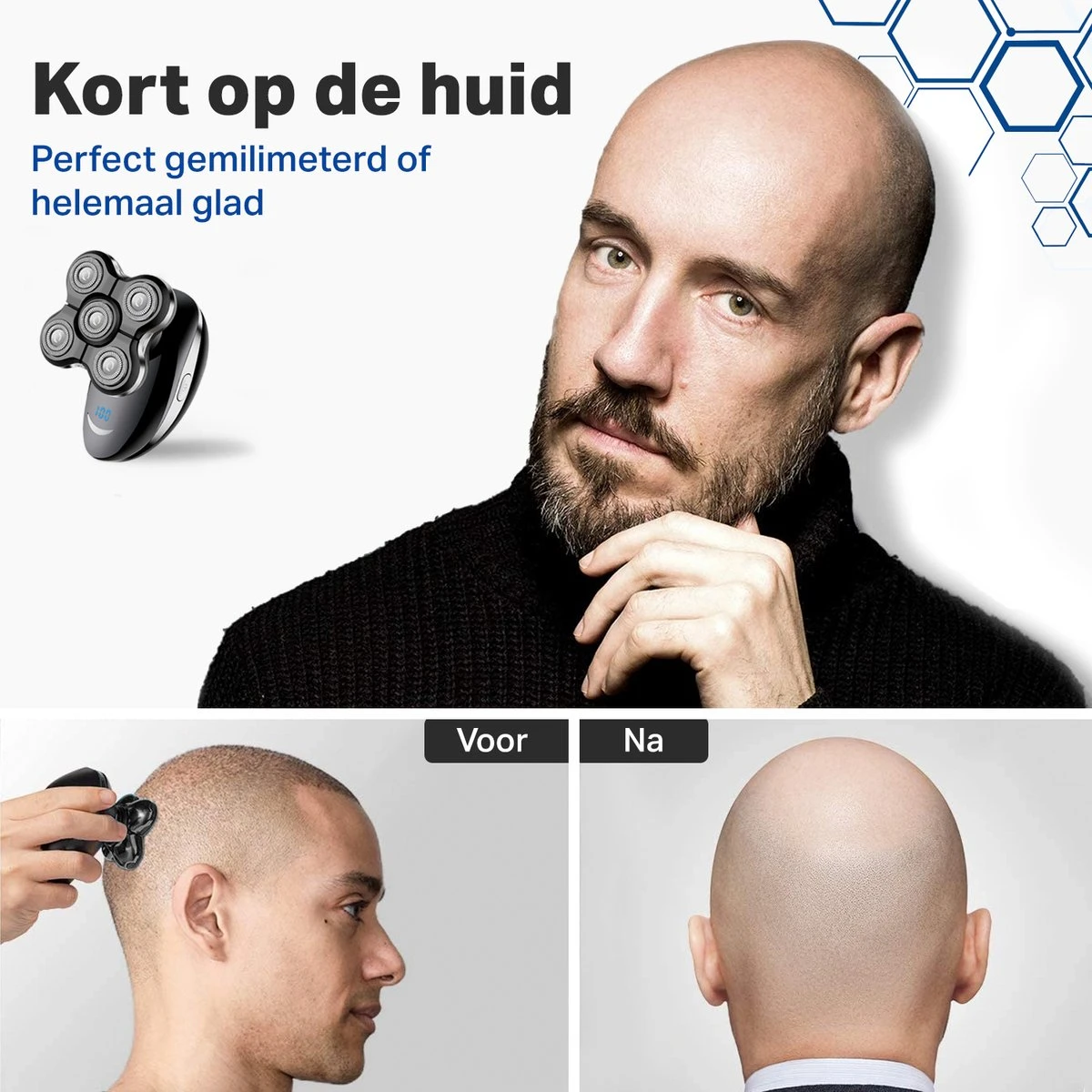 Vivid Green 5-in-1 Scheerapparaat Mannen - Trimmer - Nat En Droog Scheren - Incl. 5 Opzetstukken - Draadloos - Afbeelding 6