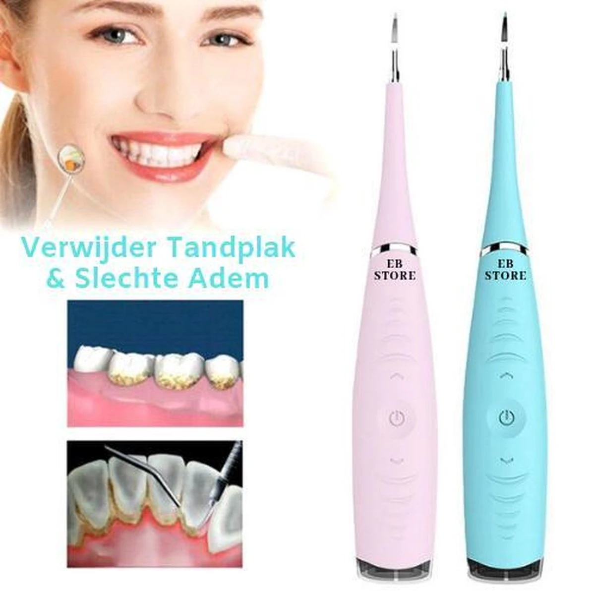 Elektrisch Tandplak Verwijderen - Flosapparaat - Slechte Adem Verhelpen - Tandsteen Weghalen - Tanden Reinigen - Thee + Koffie + Rook Aanslag Verwijderen - Gele Tanden Witten - Mond Verzorging - Tandartshaakje - Gebit Schoonmaken - EB Store - Afbeelding 2