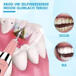DEN-T® PRO U500 - Elektrische Sonische Tandsteen Verwijderaar - Roze -BaByliss Verkoopwinkel 1200x1200 592
