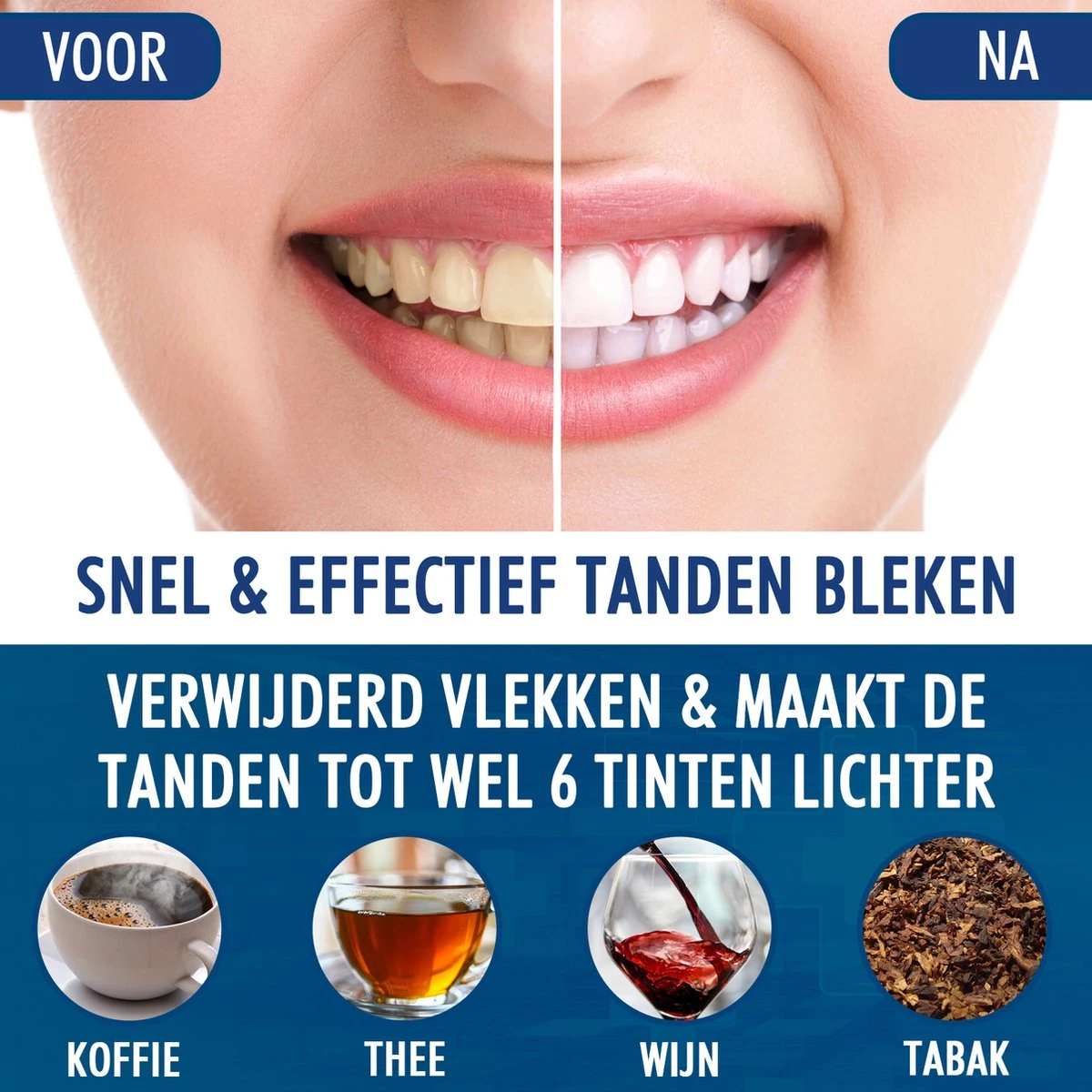 Southland Tandenbleekset - Tandenblekers - Whitening Strips - Teeth Whitening - Tanden Bleken - Afbeelding 2