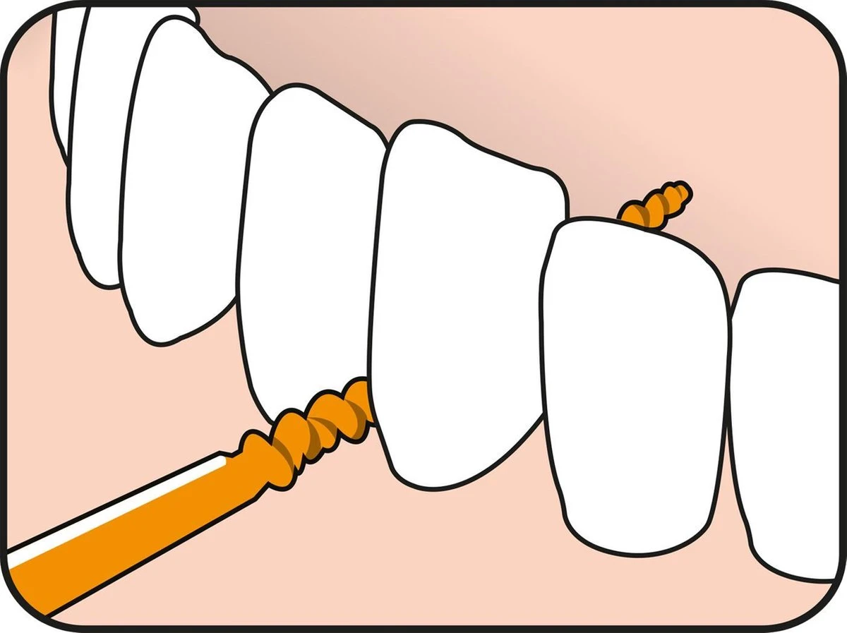 Tepe EasyPick Oranje Maat XS/S – 36 Stuks - Afbeelding 4