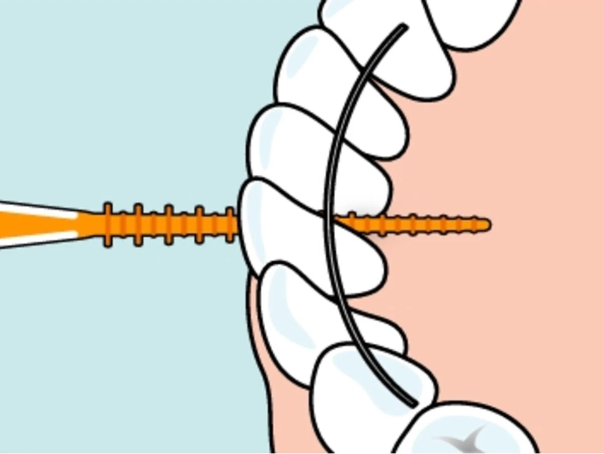 Tepe EasyPick Oranje Maat XS/S – 36 Stuks - Afbeelding 6