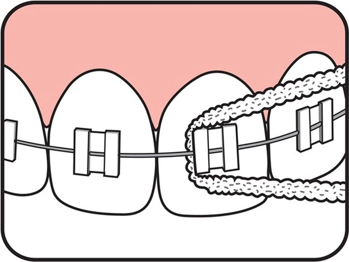 Tepe Floss Bridge & Implant 30 St 7 Tepe Floss Bridge & Implant 30 St - Afbeelding 5