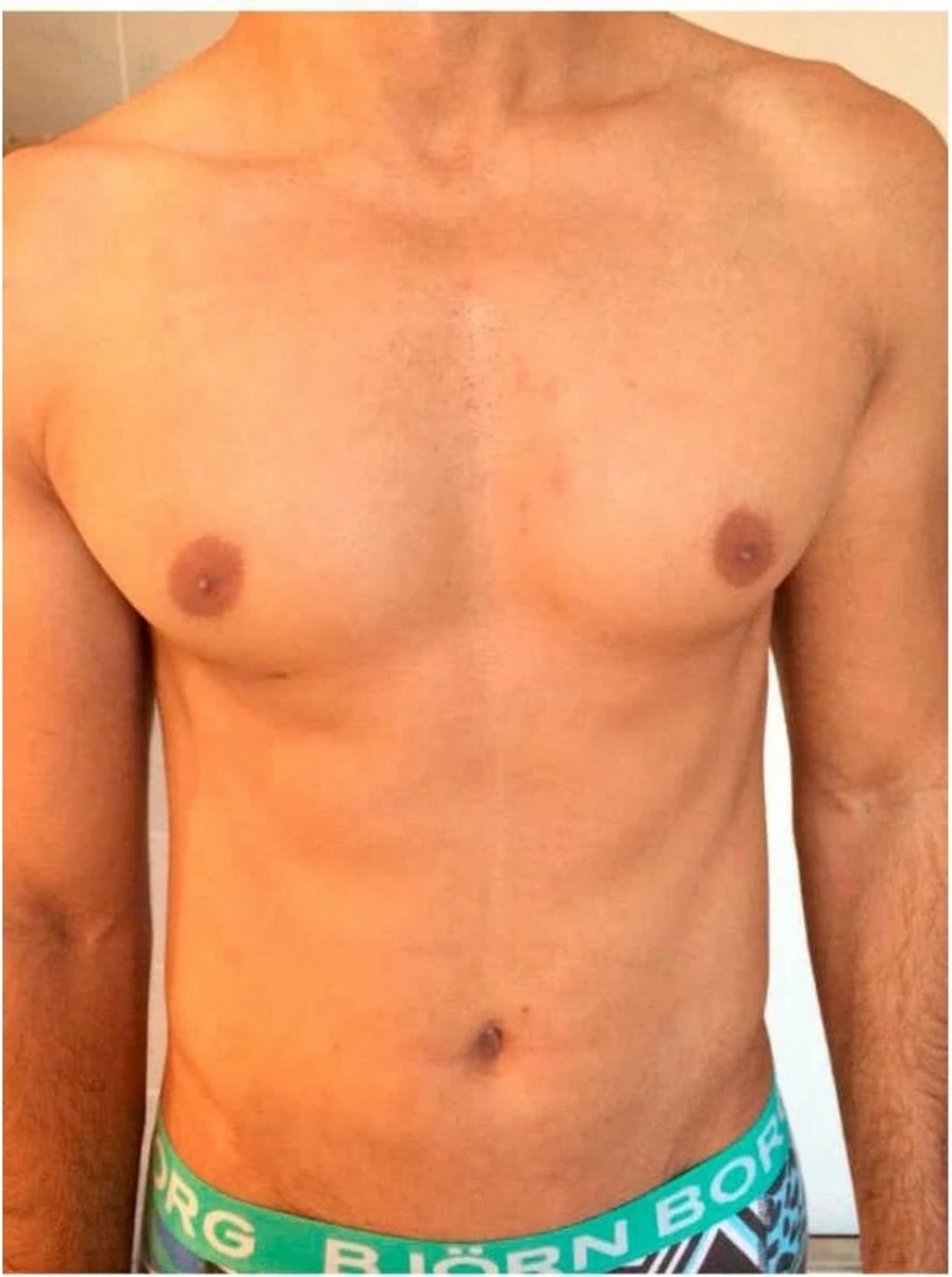 Intimate - Hair Removal Ontharingspoeder - 70 Gram - Afbeelding 4